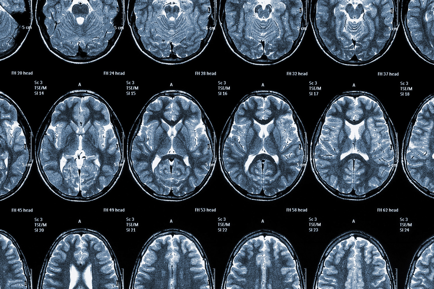 Child's MRI brain scan images